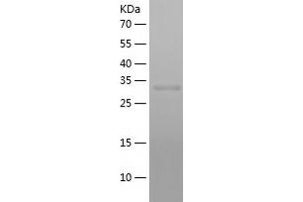 RBP3 Protein (AA 321-630) (His tag)