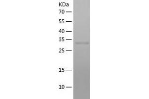 Western Blotting (WB) image for Retinol Binding Protein 3, Interstitial (RBP3) (AA 321-630) protein (His tag) (ABIN7124850) (RBP3 Protein (AA 321-630) (His tag))
