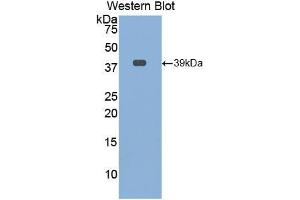 Western blot analysis of the recombinant protein. (Osteocalcin antibody  (AA 21-99))