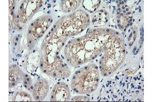 Image no. 1 for anti-Retinoic Acid Receptor Responder (Tazarotene Induced) 1 (RARRES1) antibody (ABIN1500604) (RARRES1 antibody)