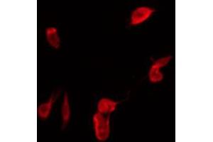 ABIN6267483 staining COS7 by IF/ICC. (IRS1 antibody  (pSer307))