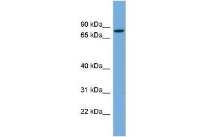 WB Suggested Anti-CRTAC1 Antibody Titration: 0. (CRTAC1 antibody  (N-Term))
