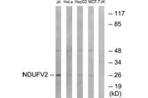 Western blot analysis of extracts from Jurkat/HeLa/HepG2/MCF-7 cells, using NDUFV2 Antibody. (NDUFV2 antibody  (AA 20-69))