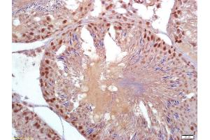 Formalin-fixed and paraffin embedded rat testis labeled with Anti-Parkin protein/PARK2 Polyclonal Antibody, Unconjugated (ABIN735578) at 1:200 followed by conjugation to the secondary antibody and DAB staining (Parkin antibody  (AA 361-465))