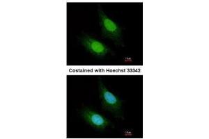ICC/IF Image Immunofluorescence analysis of paraformaldehyde-fixed HeLa, using ZC3H12A, antibody at 1:200 dilution. (ZC3H12A antibody)