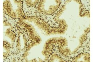 ABIN6276994 at 1/100 staining Mouse colon tissue by IHC-P. (TFF3 antibody  (Internal Region))
