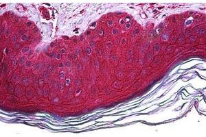 Human Skin: Formalin-Fixed, Paraffin-Embedded (FFPE) (FBXO11 antibody  (AA 744-844))