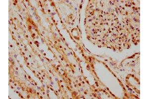 IHC image of ABIN7127547 diluted at 1:66. (Recombinant HNRNPC antibody)