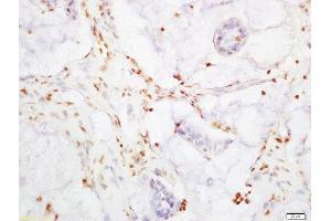 Immunohistochemistry (Paraffin-embedded Sections) (IHC (p)) image for anti-Yes-Associated Protein 1 (YAP1) (AA 131-330) antibody (ABIN701485)