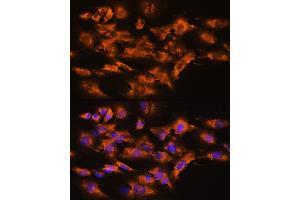 Immunofluorescence analysis of NIH/3T3 cells using  Rabbit pAb (ABIN3021619, ABIN3021620, ABIN3021621 and ABIN6215402) at dilution of 1:100. (Arrestin 3 antibody  (AA 300-400))