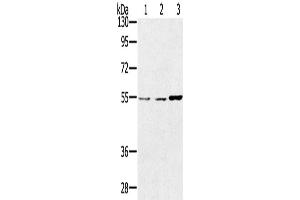 Western Blotting (WB) image for anti-Sestrin 2 (SESN2) antibody (ABIN2433786) (Sestrin 2 antibody)