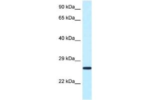 WB Suggested Anti-Nudt16 Antibody Titration: 1. (NUDT16 antibody  (N-Term))