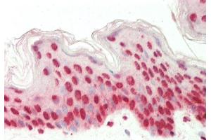 Rabbit Anti-EIF6 antibody Catalog Number: ARP61387 Formalin Fixed Paraffin Embedded Tissue: Human Skin Primary antibody Concentration: 1:100 Secondary Antibody: Donkey anti-Rabbit-Cy3 Secondary Antibody Concentration: 1:200 Magnification: 20x Exposure Time: 0. (EIF6 antibody  (C-Term))