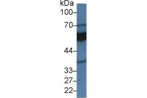 Detection of MAOA in Rat Kidney lysate using Polyclonal Antibody to Monoamine Oxidase A (MAOA) (Monoamine Oxidase A antibody  (AA 2-497))