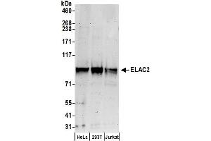 Western Blotting (WB) image for anti-ElaC Homolog 2 (ELAC2) (AA 150-200) antibody (ABIN7455053) (ELAC2 antibody  (AA 150-200))