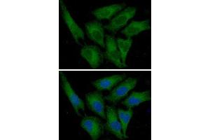 ICC/IF analysis of PAI1 in HeLa cells line, stained with DAPI (Blue) for nucleus staining and monoclonal anti-human PAI1 antibody (1:100) with goat anti-mouse IgG-Alexa fluor 488 conjugate (Green) (PAI1 antibody  (AA 24-402))