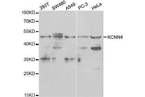 Western blot analysis of extracts of various cell lines, using KCNN4 antibody.