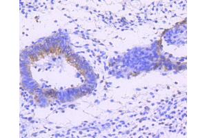 Immunohistochemistry (Paraffin-embedded Sections) (IHC (p)) image for anti-SMAD, Mothers Against DPP Homolog 2 (SMAD2) (pThr183), (pThr221) antibody (ABIN3061343)