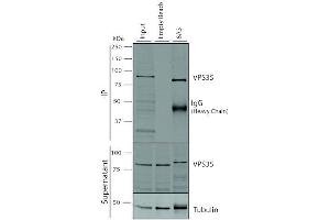 Immunoprecipitation (IP) image for anti-Vacuolar Protein Sorting 35 (VPS35) antibody (Atto 488) (ABIN6932958)