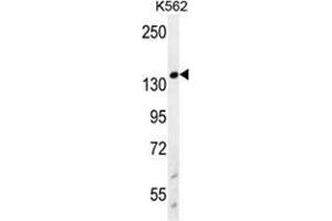 WRN Antibody (Center T802) western blot analysis in K562 cell line lysates (35 µg/lane). (RECQL2 antibody  (Middle Region, Thr802))