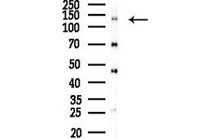 anti-Tripartite Motif Containing 24 (TRIM24) (C-Term) antibody