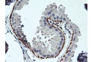 Immunohistochemical staining of paraffin-embedded Human breast tissue using anti-RFXANK mouse monoclonal antibody. (RFXANK antibody)