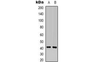 Western blot analysis of MKK6 expression in Hela (A), HEK293T (B) whole cell lysates. (MAP2K6 antibody  (N-Term))