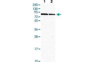 Western blot analysis of Lane 1: Human cell line RT-4 Lane 2: Human cell line U-251MG with RNF10 polyclonal antibody  at 1:250-1:500 dilution. (RNF10 antibody)