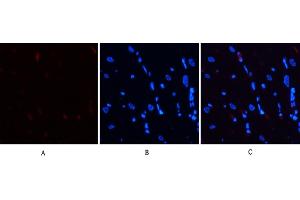 Immunofluorescence analysis of rat heart tissue. (STAT3 antibody  (pSer727))