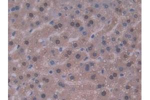 Detection of IL22 in Mouse Liver Tissue using Polyclonal Antibody to Interleukin 22 (IL22) (IL-22 antibody  (AA 34-179))