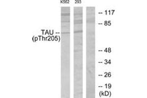 Western blot analysis of extracts from K562 cells and 293 cells, using Tau (Phospho-Thr205) Antibody. (tau antibody  (pThr522))