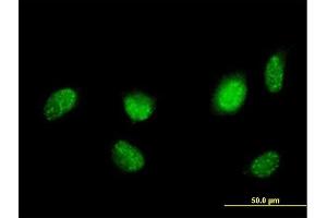 Immunofluorescence of purified MaxPab antibody to HNF4A on HeLa cell. (HNF4A antibody  (AA 1-464))