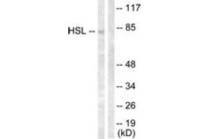 Western blot analysis of extracts from HeLa cells, treated with Calyculin A 100nM 30', using HSL (Ab-554) Antibody. (LIPE antibody  (AA 520-569))