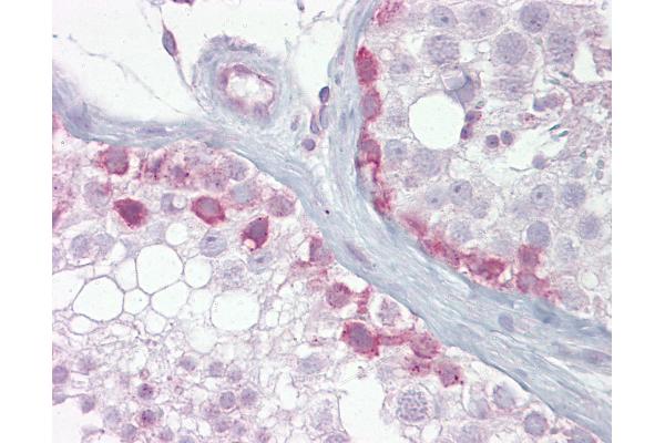 SYCP1 antibody  (AA 72-121)