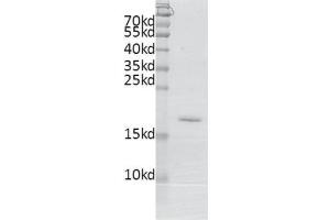 Recombinant BRDT (21-137) protein gel. (BRDT Protein (AA 21-137) (His tag,DYKDDDDK Tag))