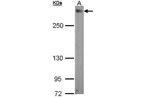 WB Image Sample (30 ug of whole cell lysate) A: A549 5% SDS PAGE antibody diluted at 1:1000 (PDZD2 antibody  (N-Term))