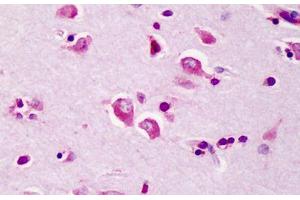 Human Brain: Formalin-Fixed, Paraffin-Embedded (FFPE) (TRAF3 antibody  (C-Term))