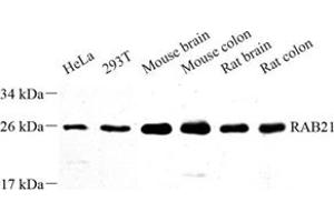Western blot analysis of RAB21 (ABIN7075341) at dilution of 1: 500 (RAB21 antibody)