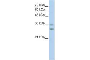 Western Blotting (WB) image for anti-Forkhead Box Q1 (FOXQ1) antibody (ABIN2460797)