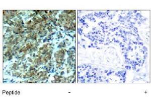 Image no. 2 for anti-Cortactin (CTTN) (Tyr466) antibody (ABIN197532) (Cortactin antibody  (Tyr466))