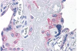 Human Placenta: Formalin-Fixed, Paraffin-Embedded (FFPE) (FNIP2 antibody  (N-Term))