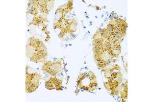 Immunohistochemistry of paraffin-embedded human stomach using ELN antibody at dilution of 1:100 (x40 lens).