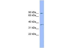 WB Suggested Anti-SDCCAG8 Antibody Titration: 0. (SDCCAG8 antibody  (N-Term))