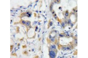 Used in DAB staining on fromalin fixed paraffin-embedded pancreas tissue (TWEAK antibody  (AA 53-249))