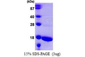 ATP5F1D Protein (AA 23-168) (His tag)
