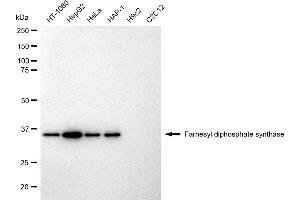 Western blotting analysis using Farnesyl diphosphate synthase antibody (ABIN7798569).
