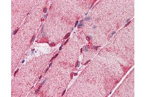 Immunohistochemistry (IHC) image for anti-Acyl-CoA Synthetase Long-Chain Family Member 5 (ACSL5) (C-Term) antibody (ABIN2782881) (ACSL5 antibody  (C-Term))