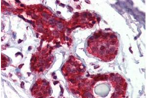 Breast, Human: Formalin-Fixed, Paraffin-Embedded (FFPE) (eIF4EBP1 antibody  (AA 101-118))