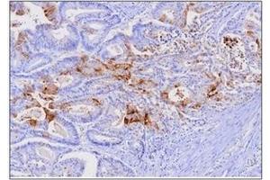 Immunohistochemistry (IHC) image for anti-Fatty Acid Binding Protein 1, Liver (FABP1) (AA 1-127), (N-Term) antibody (ABIN317518) (FABP1 antibody  (N-Term))
