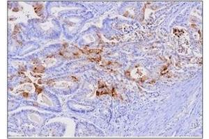 Immunohistochemistry (IHC) image for anti-Fatty Acid Binding Protein 1, Liver (FABP1) (AA 1-127), (N-Term) antibody (ABIN317519) (FABP1 antibody  (N-Term))